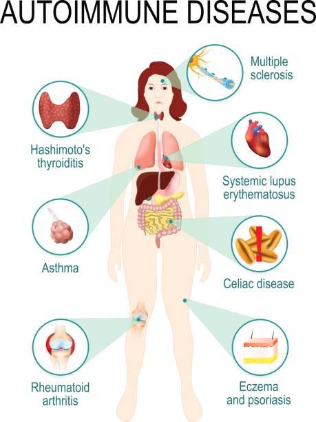 Autoimmune Diseases