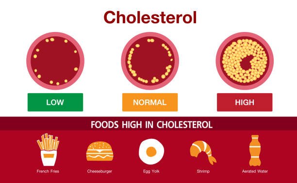 Cholesterol 